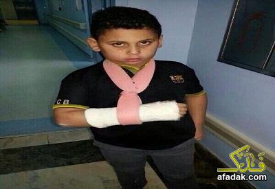 أستاذ دين سلفي متشدد يكسر يد الطفل علي رضا الفضل الطالب في المرحلة الابتدائية في مدرسة الحسن بن علي في جزيرة تاروت (شرق السعودية)